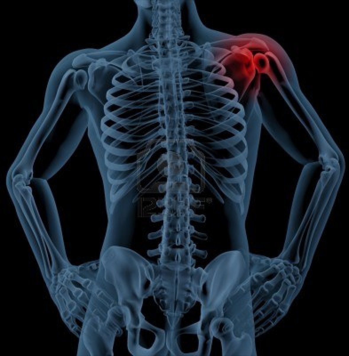 Il dolore muscolare non risparmia (quasi) nessuno
