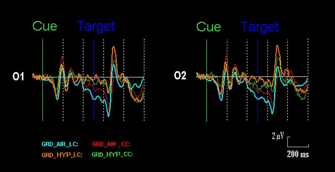 Ipossia: il cervello è meno vigile