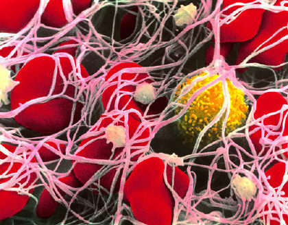 Le piastrine non sono uguali per tutti