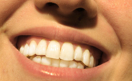 Manca il pane e pure i denti
