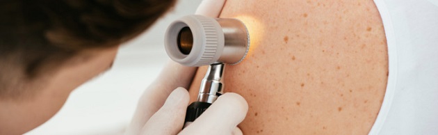 Melanoma: un destino che può cambiare