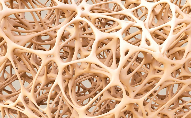 Osteoporosi: i benefici del collagene