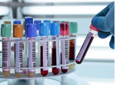 Svelata insidia tattoo, nanoparticelle inchiostro viaggiano nel corpo